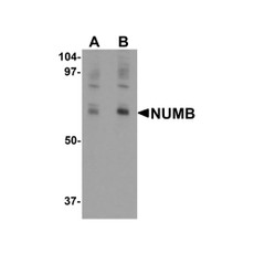 ProSci 6311 NUMB Antibody