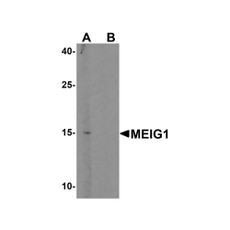 ProSci 6381 MEIG1 Antibody