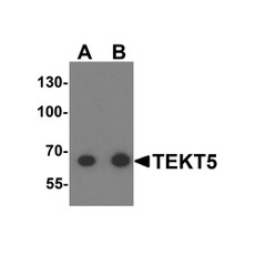 ProSci 6383 TEKT5 Antibody
