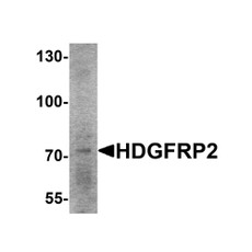 ProSci 6411 HDGFRP2 Antibody