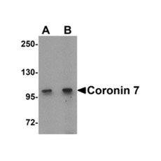 ProSci 6451 Coronin 7 Antibody
