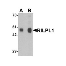 ProSci 6495 RILPL1 Antibody
