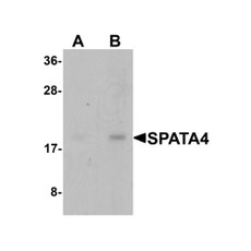 ProSci 6553 SPATA4 Antibody