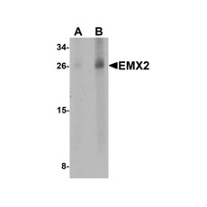 ProSci 6627 EMX2 Antibody