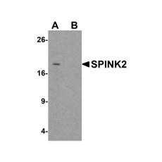 ProSci 6667 SPINK2 Antibody