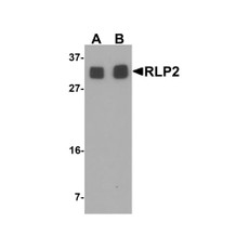 ProSci 6799 RLP2 Antibody