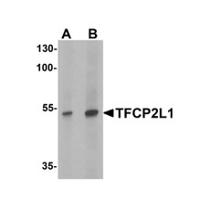 ProSci 6807 TFCP2L1 Antibody