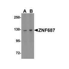 ProSci 6861 ZNF687 Antibody