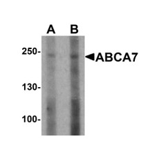 ProSci 6889 ABCA7 Antibody