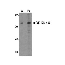 ProSci 7015 CDKN1C Antibody