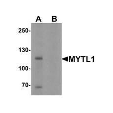 ProSci 7083 MYT1L Antibody