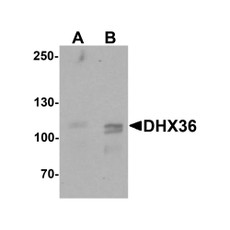 ProSci 7163 DHX36 Antibody