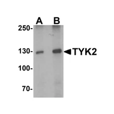 ProSci 7177 TYK2 Antibody