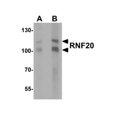 ProSci 7357 RNF20 Antibody