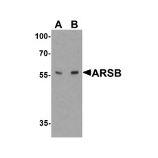 ProSci 7465 ARSB Antibody