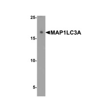 ProSci 7579 MAP1LC3A Antibody