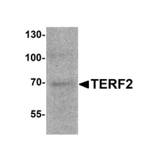 ProSci 7727 TERF2 Antibody