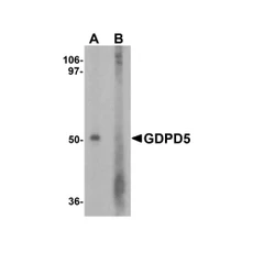 ProSci 7739 GDPD5 Antibody