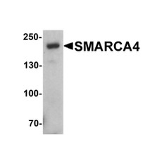 ProSci 7749 SMARCA4 Antibody