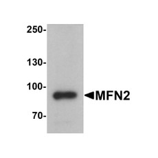 ProSci 7863 MFN2 Antibody