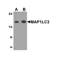 ProSci 7951 MAP1LC3 Antibody