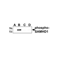 ProSci 8005 SAMHD1 (phospho Thr592) Antibody