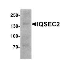 ProSci 8011 IQSEC2 Antibody