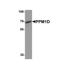 ProSci 8043 PPM1D Antibody