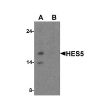 ProSci 8055 HES5 Antibody