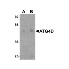ProSci 8075 ATG4D Antibody