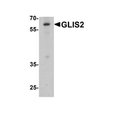 ProSci 8091 GLIS2 Antibody