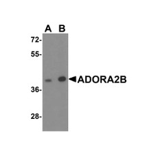 ProSci 8111 ADORA2B Antibody