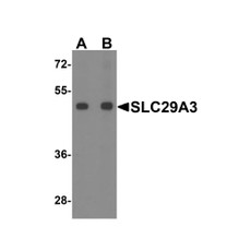 ProSci 8129 SLC29A3 Antibody