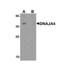 ProSci 8141 DNAJA4 Antibody