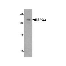 ProSci 8153 RSPO3 Antibody
