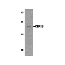 ProSci 8157 SPIB Antibody