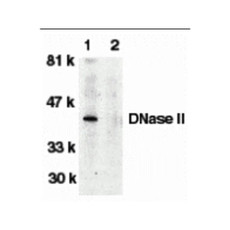 ProSci 2059 DNase II Antibody