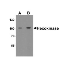 ProSci 8217 Hexokinase 1 Antibody