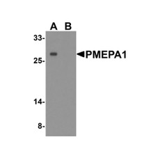 ProSci 8261 PMEPA1 Antibody