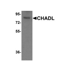 ProSci 8423 CHADL Antibody