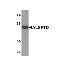 ProSci 8469 ALSFTD Antibody