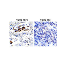 ProSci 9087 SARS-CoV-2 (COVID-19) Spike RBD Antibody