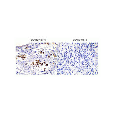 ProSci 9123 SARS-CoV-2 (COVID-19) Spike S2 Antibody