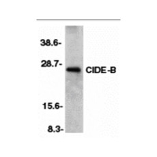 ProSci 2091 CIDE-B Antibody