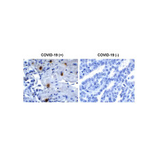 ProSci 9179 SARS-CoV-2 (COVID-19) NSP10 Antibody