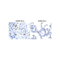 ProSci 9185 SARS-CoV-2 (COVID-19) NSP14 (ExoN) Antibody