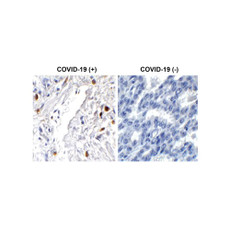 ProSci 9285 SARS-CoV-2 (COVID-19) ORF7a Antibody