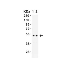 ProSci 9645 MNDA (CT) Antibody