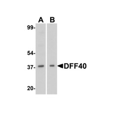 ProSci 2155 DFF40 Antibody
