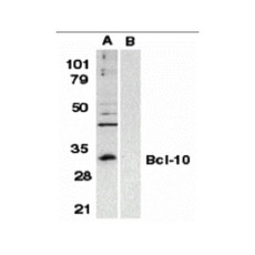ProSci 2161 Bcl-10 Antibody